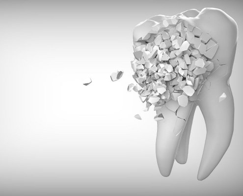 Odontoiatria Conservativa