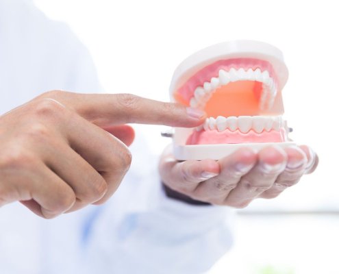 Pulire Protesi Dentarie Mobili