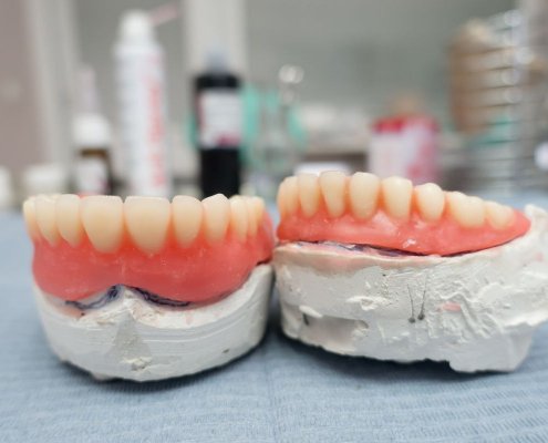 Protesi Dentali Mobili