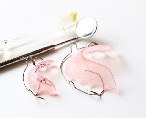 Ortodonzia Infantile