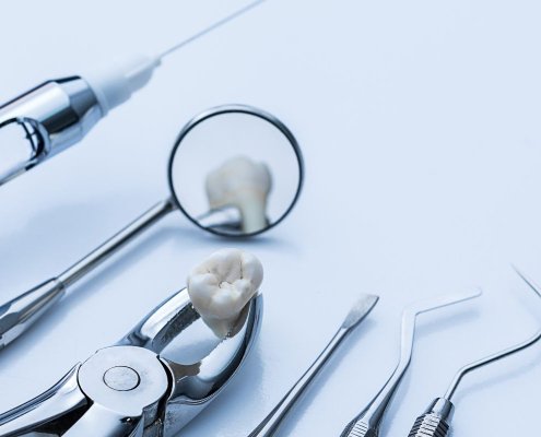 Alveolite post-estrattiva