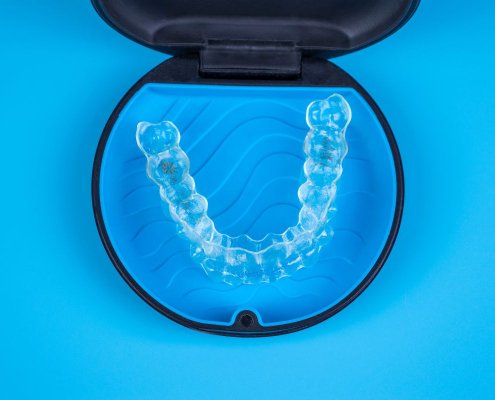 Allineatori Trasparenti