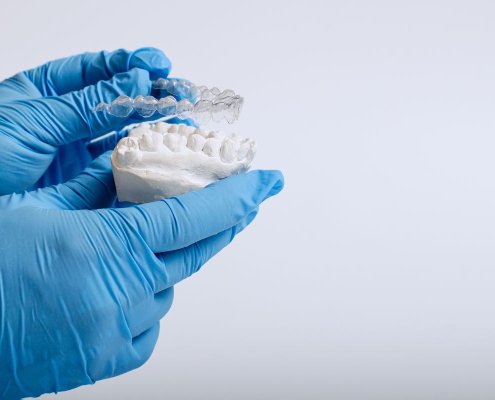 Trattamento Ortodontico