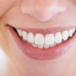 Devitalizzazione e Otturazione dente