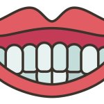 Sorriso_Gengivale_Trattamento