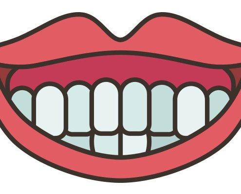 Sorriso_Gengivale_Trattamento