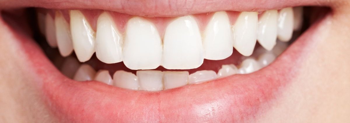 Come rimuovere macchie dai denti