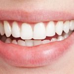 Come rimuovere macchie dai denti