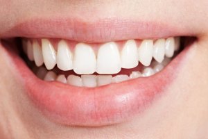 Come rimuovere macchie dai denti