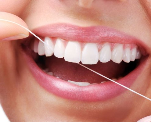Filo interdentale